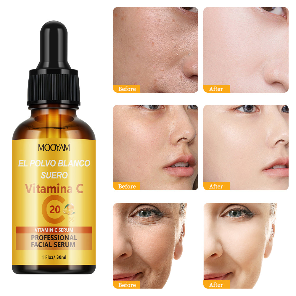 MOOYAM Professional Facial Serum à la Vitamine C