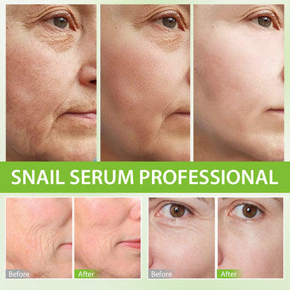 MOOYAM Professional Facial Serum à la Bave d’Escargot