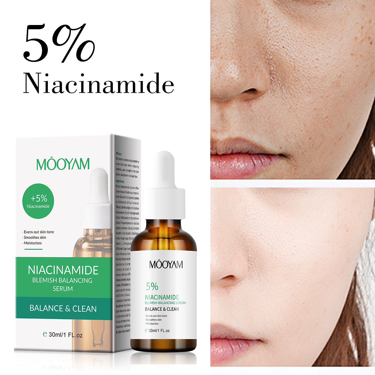 MOOYAM Niacinamide 5% Blemish Balancing Serum