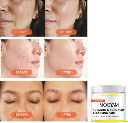 MOOYAM Turmeric & Kojic Acid Cleansing Pads