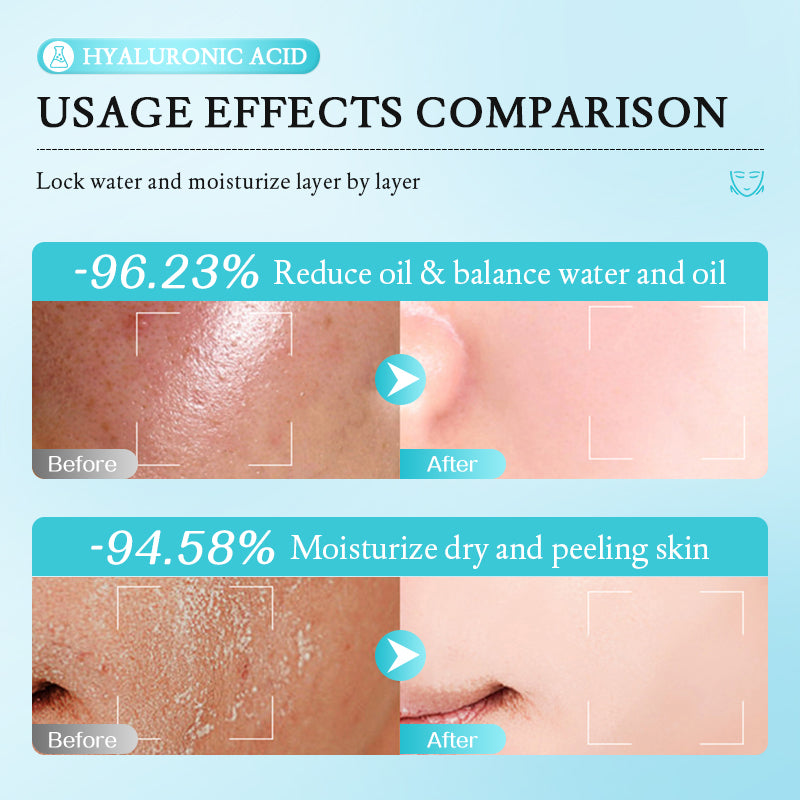 Coffret MOOYAM à l’Acide Hyaluronique