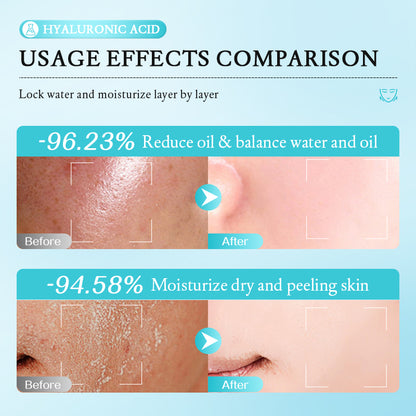 Coffret MOOYAM à l’Acide Hyaluronique