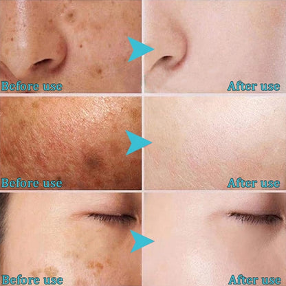 Crème Éclaircissante Visage – MOOYAM Brightening Cream