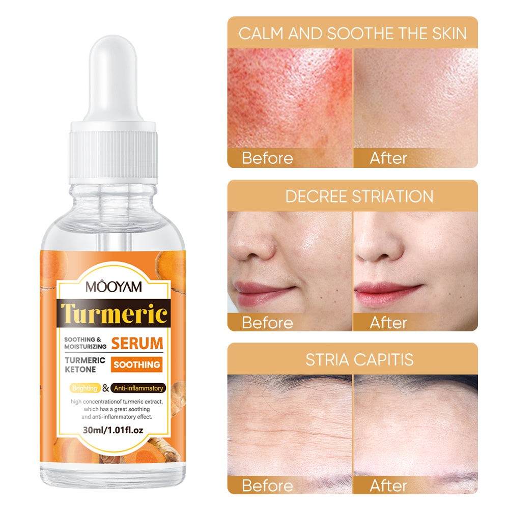 MOOYAM Turmeric Soothing & Moisturizing Serum
