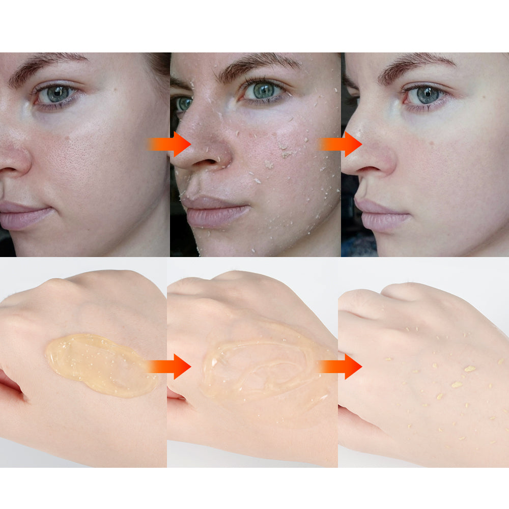 MOOYAM Lemon Sparkling Peeling Gel